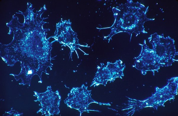 Ученые создали усыпляющее раковые клетки вещество
