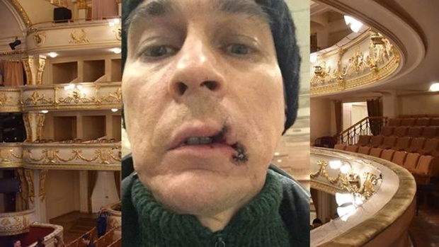 В Екатеринбурге оперный певец порвал рот во время спектакля