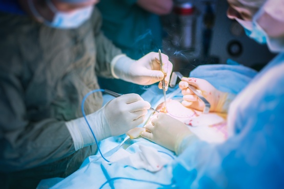 Операция прошла успешно: в Тюмени женщине из черепа удалили опухоль размером с кулак