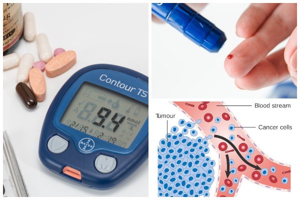 Учёные нашли связь между диабетом и раком