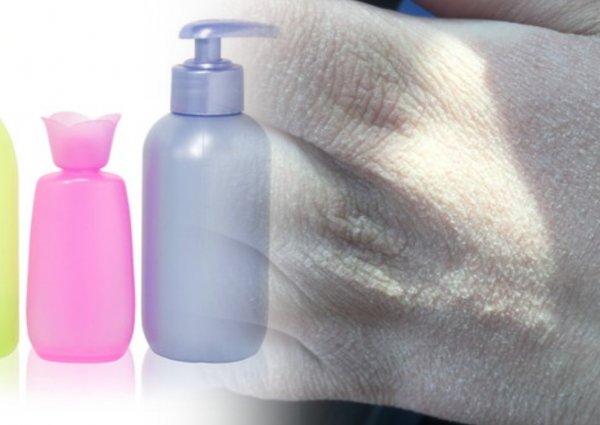 Аллергия в баночке: Как жидкое мыло «Бархатные ручки» уничтожает кожу рук